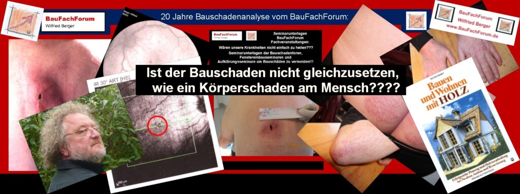 Ist die Krankheit der Menschen nicht gleich wie die der Bausubstanz?
Wenn wir uns dieses Bild mit menschlichen Krankheit mit Haut und Drüsen-Problematik sowie den Augen anschauen, sehen wir hier dramatische Krankheiten der Menschen. 
Das könnt uns ja jetzt nicht tangieren.
Aber in der Folge und den Folien der Fortbildungen erkennt Ihr ja deutlich, dass die Bausubstanz mit den gleichen Krankheiten belastet ist wie der Mensch!!! 
Allerdings sprechen wir hier nicht von Neurodermitis, Wasser in den Füßen mit Herzkrankheit oder Stoffwechselproblemen. Wir reden im Bauwesen von Fundament mit Wasser, Abgesoffene Bausubstanz, Wasserproblemen physikalisch und durch Niederschlagswasser, Kondensat-Problemen und chemischen wie bauphysikalischen Fehverhalten der Baumeister.
Einfach das Bild anklicken und Ihr kommt auf ein spannendes Video vom BauFachForum meist zur Sache direkt. Dabei verlasst Ihr das BauFachForum und kommt auf unsere YouTube Seite.    
